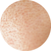 Enlarged Pore Tissue